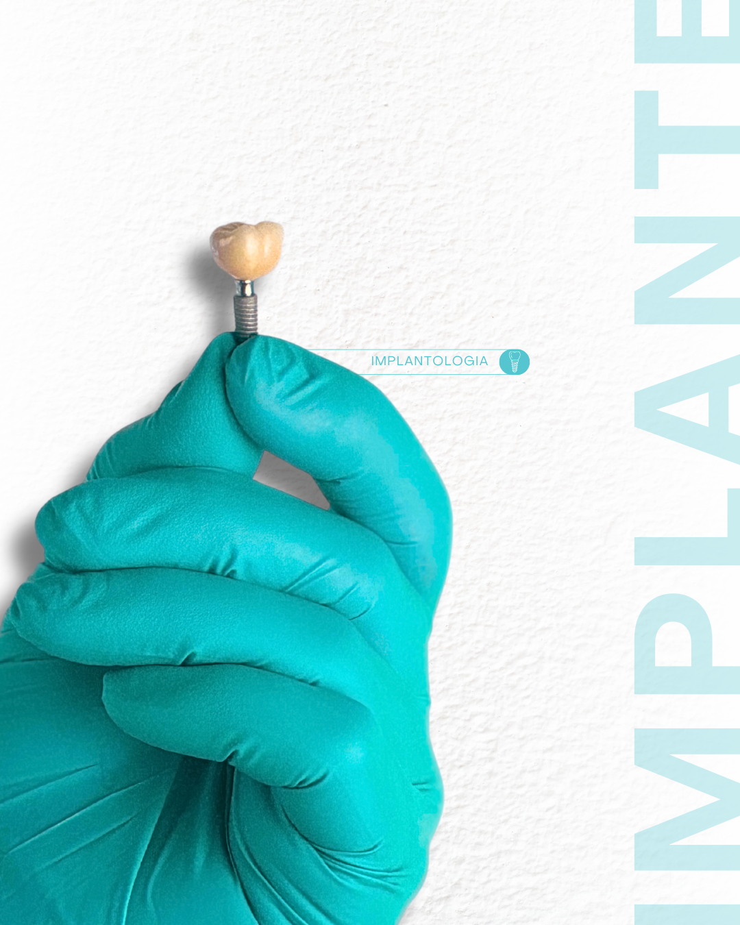 implantes dentários